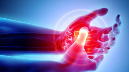 Periodontal disease more common in patients with rheumatoid arthritis