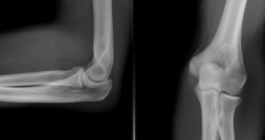 Nowa technologia wytwarzania kości
