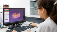 AI shows close agreement with experts in implant planning