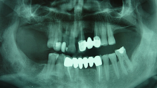 ATM e colpo di frusta: un nuovo modo di vedere le cose
