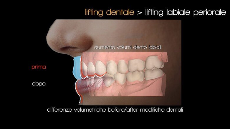 Logopedia Estetica Funzionale: quali sinergie con l’odontoiatria e la medicina estetica?