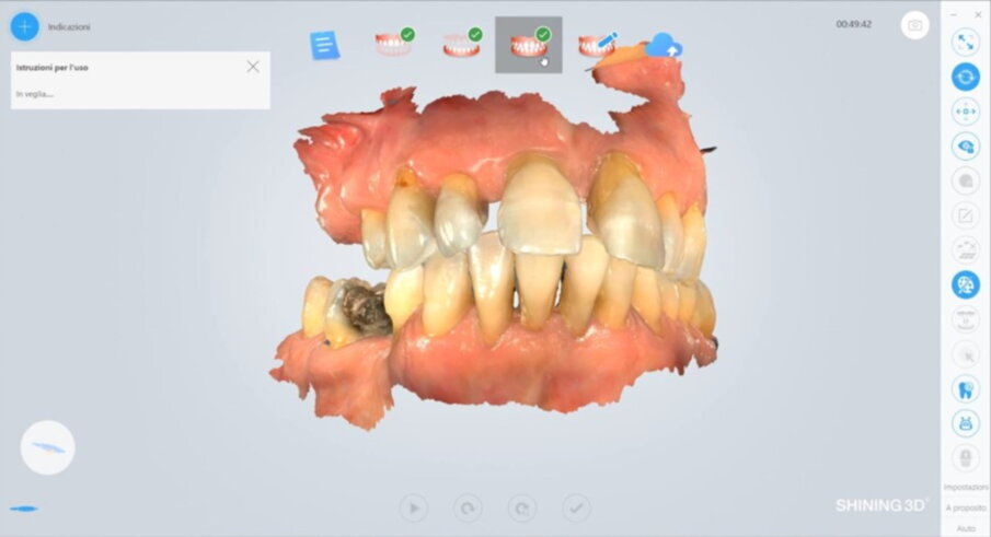 Figg. 5, 6_Arco superiore.