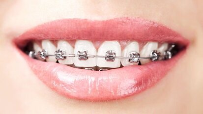 OVAP verder onder nieuwe verenigingsnaam