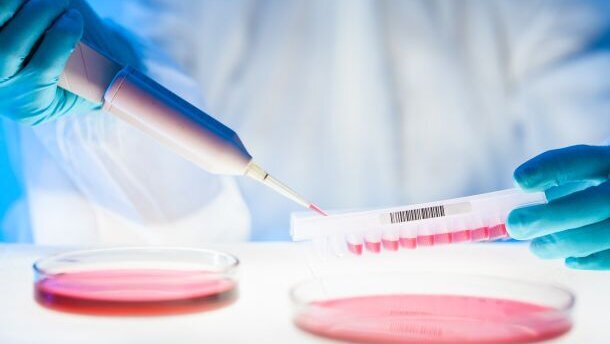 Nieuw testmodel voor cariëspreventie