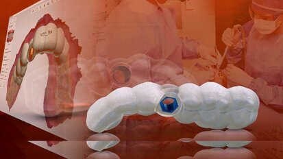 La planificación digital del tratamiento