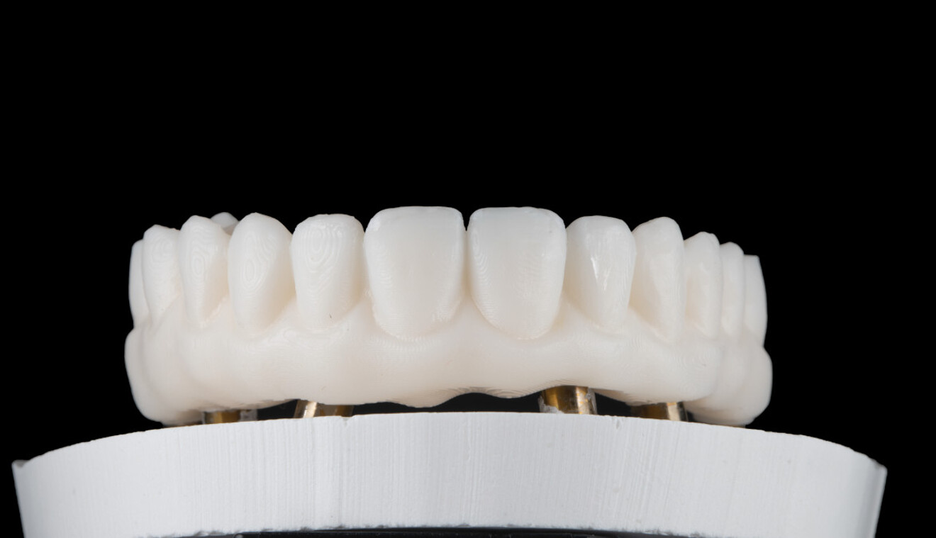 Fig. 4: 3D-printed prototype on the model.