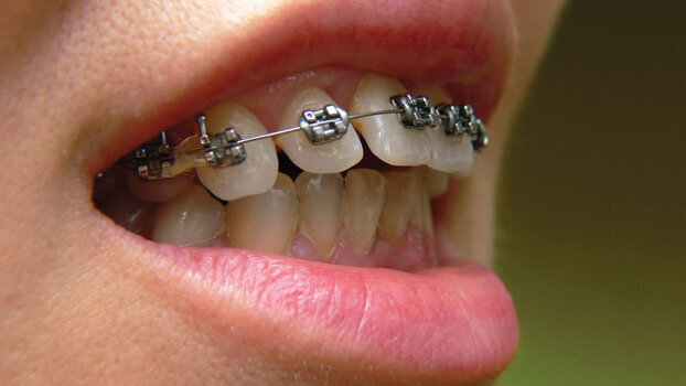 How can hygienists ‘straighten up’?