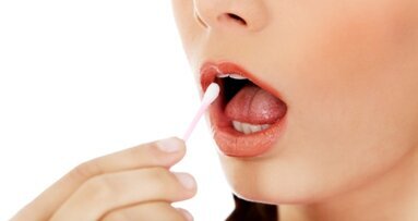 Las bacterias orales puede indicar un mayor riesgo de cáncer de páncreas