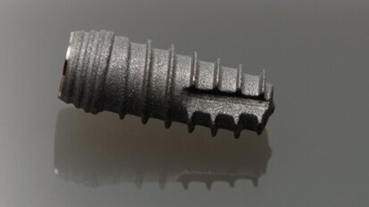 DAZ fordert Sachlichkeit in der Implantologie-Debatte