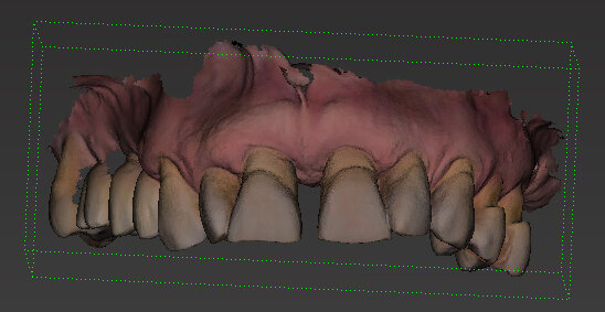 Fig. 5 - Impronta iniziale digitale.