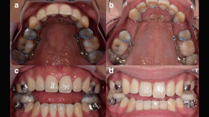 Creator of Anterior Growth Guidance Appliance is now under federal investigation Creator of Anterior Growth Guidance Appliance is now under federal investigation