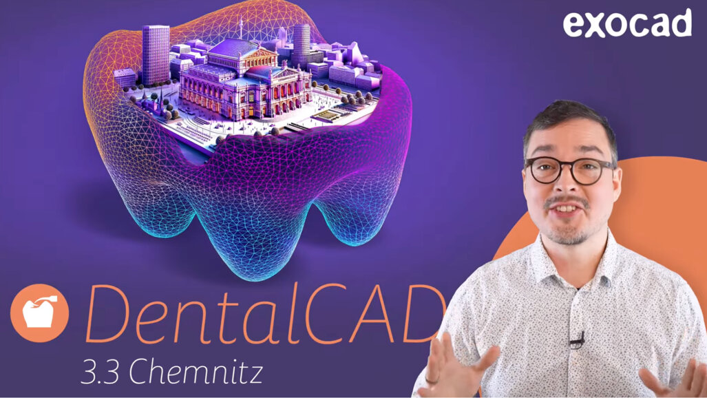 exocad – DentalCAD 3.3 Chemnitz – Highlights and Deep Dive into exocad Cloud Features