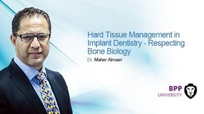 Live webinar: Administração do tecido duro em implante dentário