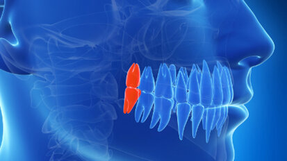 ADF 2014 : conférence « La dent de sagesse »