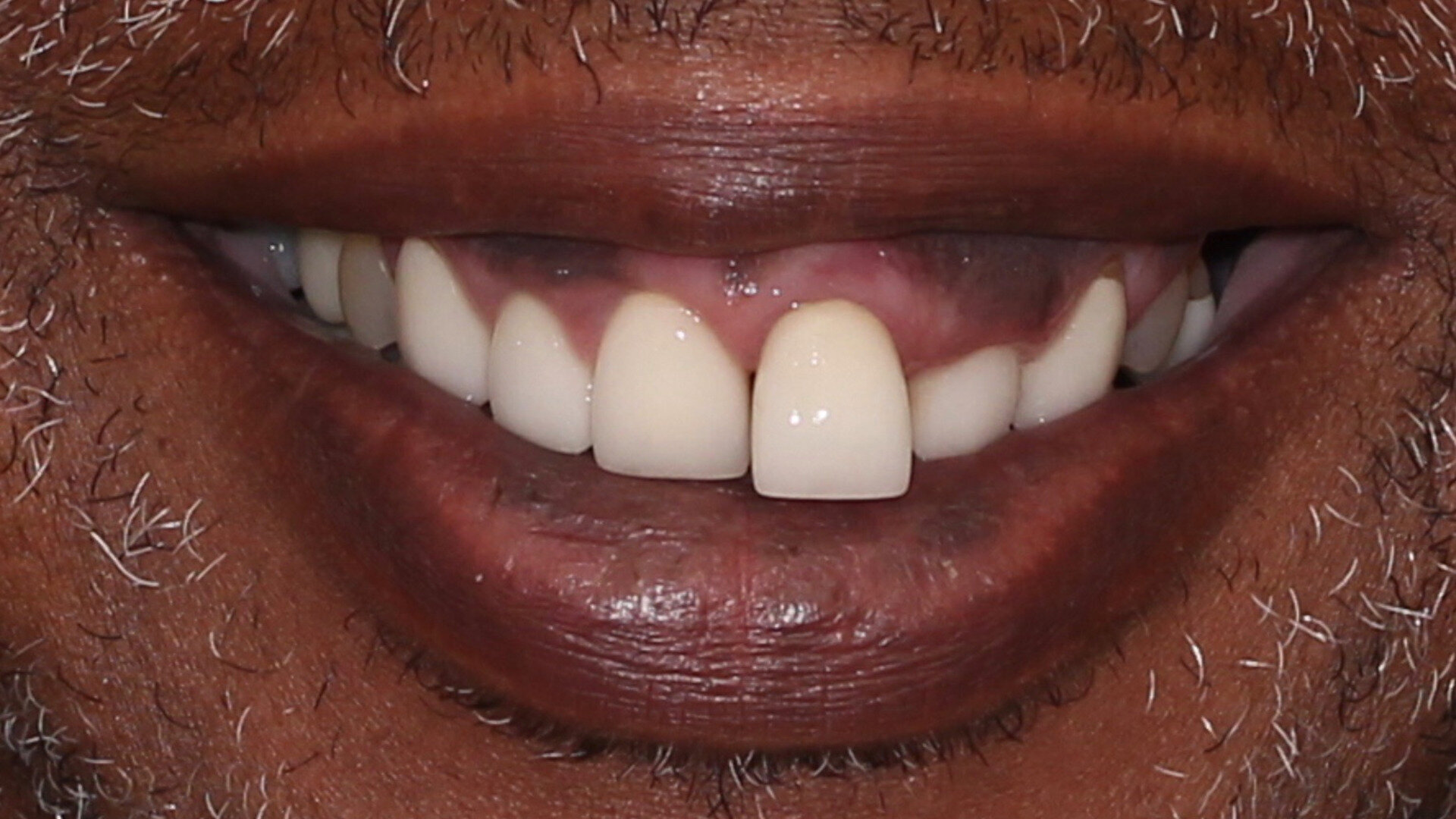 Un flux de travail numérique pour une réussite esthétique prédictible