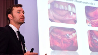 12. Leipziger Forum für Innovative Zahnmedizin: Implantologie und kontroverse Konzepte