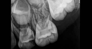 הסוכנות הבינלאומית לאנרגיה אטומית מפרסמת דו