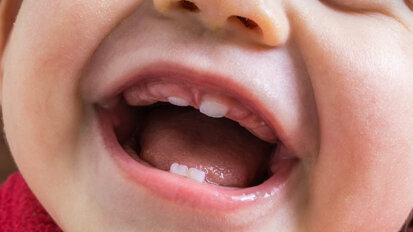 Novo estudo dá passos na direção do diagnóstico precoce do autismo