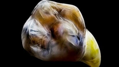 Artistik Dental Fotoğraflar IDS 2017’ye Gidiyor