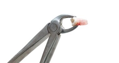 Boete voor Eurosmile wegens fraude