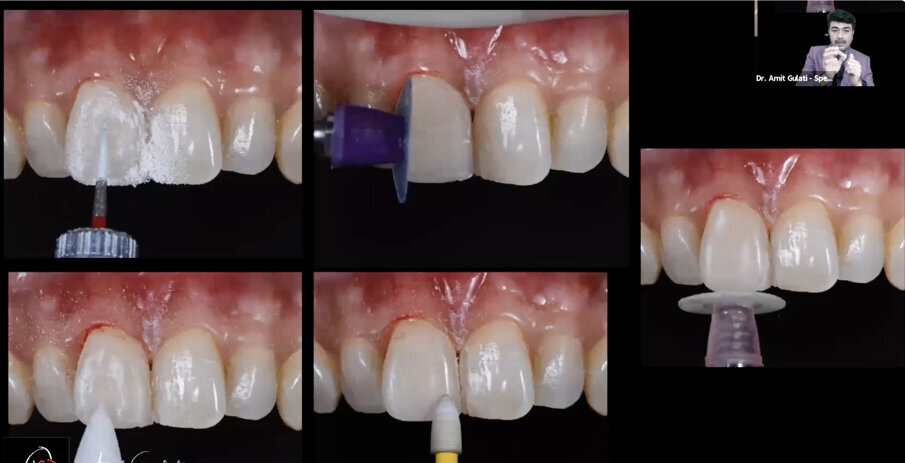 Lecture of Dr Amit Gulati, India