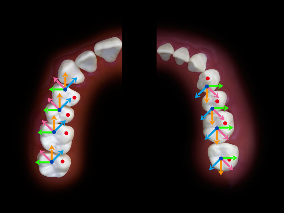 Fig. 4_Direzione dei tragitti delle cuspidi di centrica a partire dalla massima intercuspidazione. 