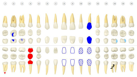 Henry Schein unveils beta version of cloud-based Dentrix Ascend practice management system