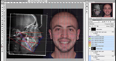 Comunicazione e progettazione software assistita open source utile alla stampa 3D del mock up