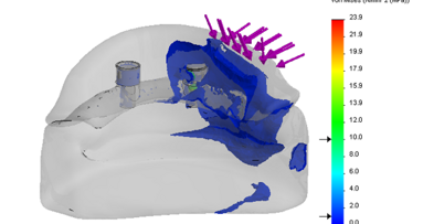 Numeryczna weryfikacja problematyki mocowania protezy całkowitej dolnej wspartej o 1 lub 2 wszczepy