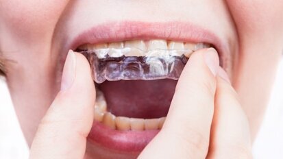 Três perguntas para Keith Batcheller, ClearCorrect