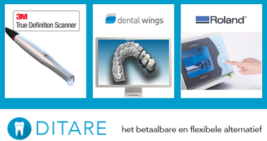 Mardent introduceert nieuw chairside behandelconcept DITARE