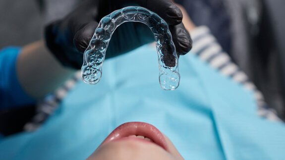 Interceptive aligner treatment in a growing Class&nbsp;II, Division&nbsp;1 patient
