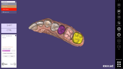 exocad – Quick Guide: Learn ChairsideCAD in 7 minutes!