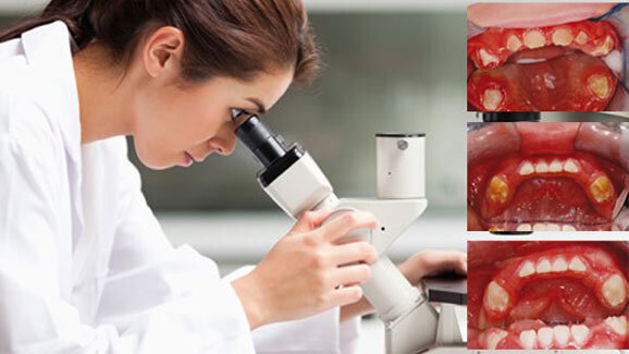 Ursache für seltene erbliche Krankheit geklärt