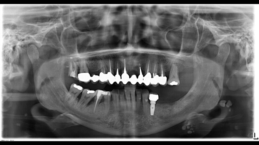 Fig. 3 - Opt iniziale.