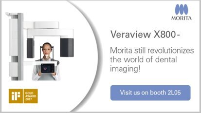 Veraview X800: More safety and precision in 3-D