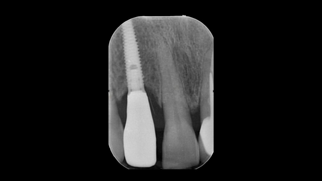 Fig. 7