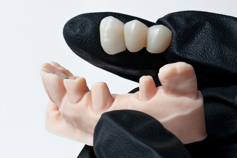 Phrozen’s technology enables the production of high-quality dental models and restorations using advanced 3D printing. 