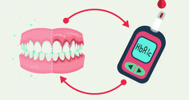 Conoscere e gestire efficacemente la correlazione tra diabete e parodontite