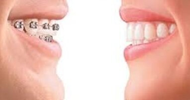 Σταυροειδής σύγκλειση