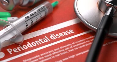Study links periodontal disease, tooth loss and higher risk of death