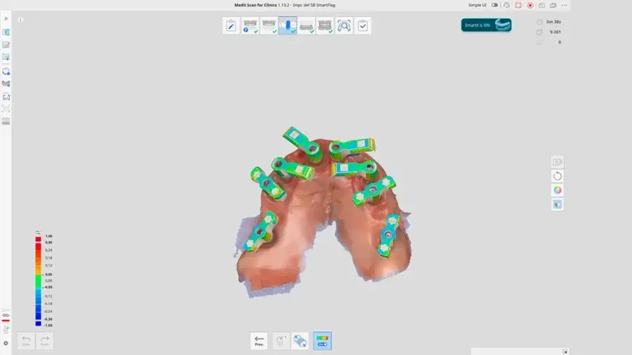 Фиг. 14: Работен процес Medit SmartX за интраорално сканиране на цялата дъга с помощта на Medit i900 и Medit Scan for Clinics (версия 1.13.2).