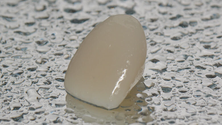 Figura 8. Corona provisional ExperTemp (Ultradent).