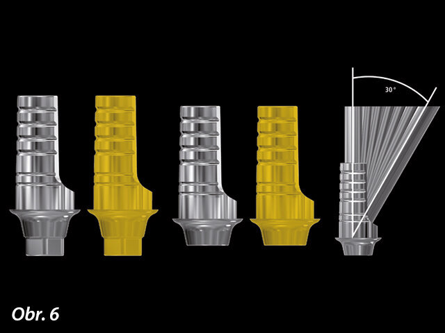Titanové báze K80 ASC s přístupovým kanálem je možné angulovat v úhlu 0–30 °.
