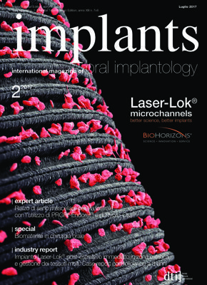 implants Italy No. 2, 2017 implants Italy No. 2, 2017