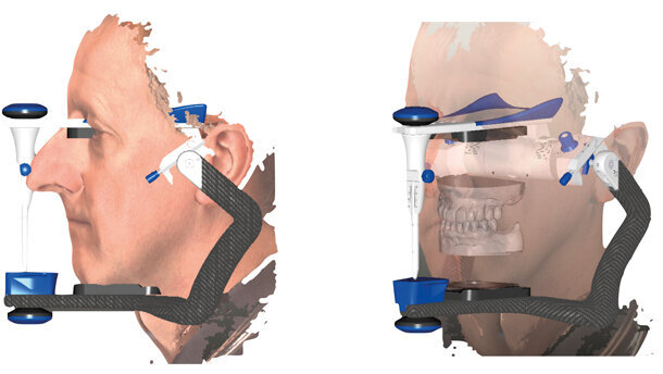 Utilizzo clinico della scansione facciale in ambito odontoiatrico