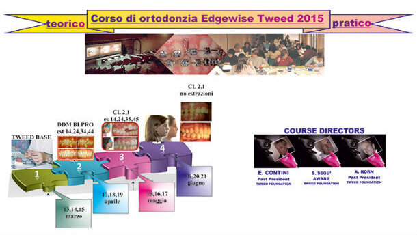 L’ortodonzia Edgewise Tweed oggi
