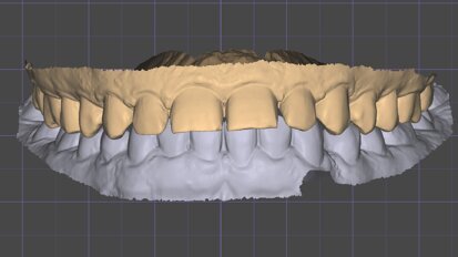 La prima visita odontostomatologica: un evento rivoluzionato dalla moderna tecnologia digitale