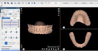 La planificación digital de la Ortodoncia en el Máster de USC