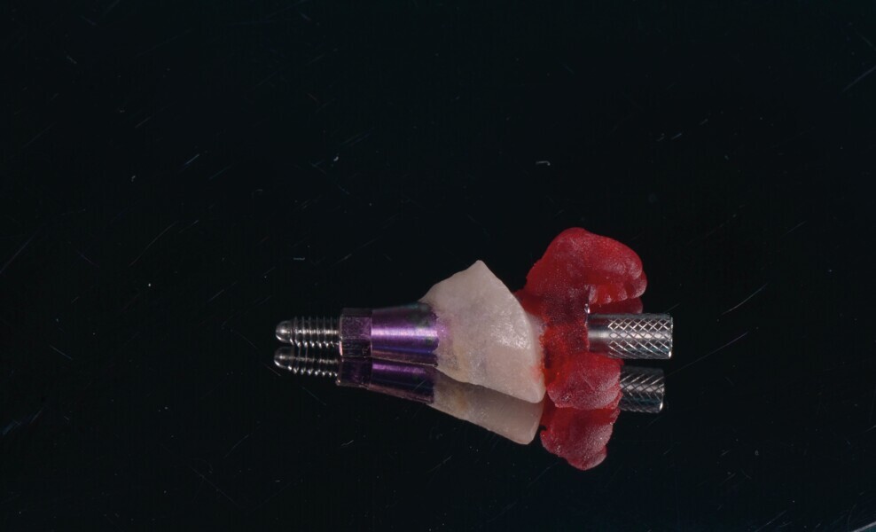 Fig. 19a : Transfert d’empreinte, 